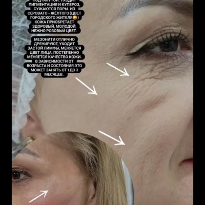 Cosmetologist constantly improving her expertise, sincere specialist Julia, @NEO_GEO_Beauty