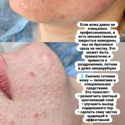 Cosmetologist constantly improving her expertise, sincere specialist Julia, @NEO_GEO_Beauty